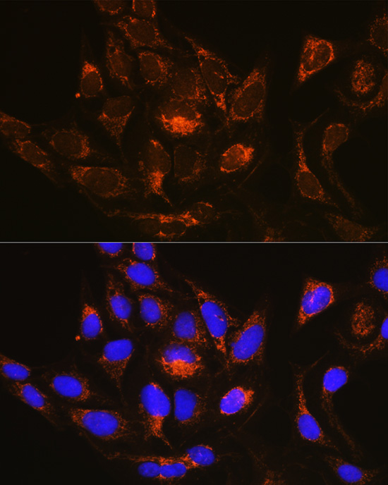 Anti-RAB13 Antibody (CAB10571)