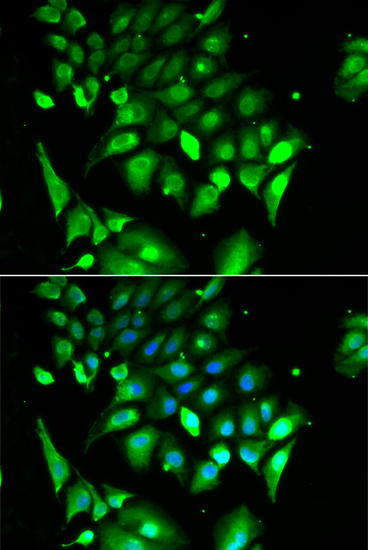 Anti-BHLHE40 Antibody (CAB6534)