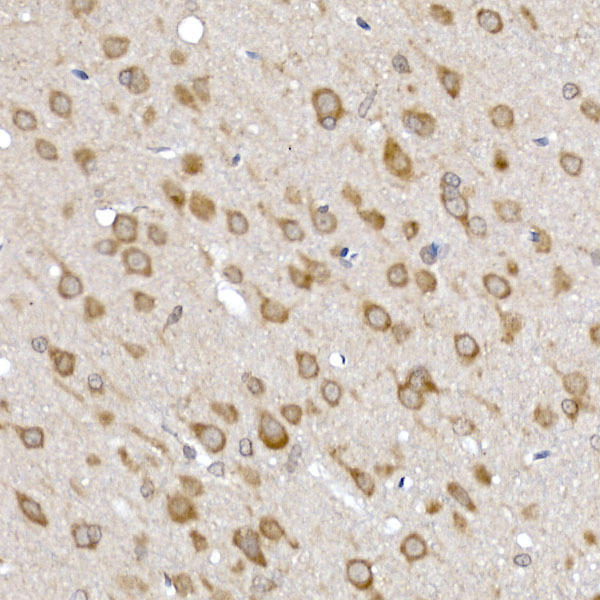 Immunohistochemistry of paraffin-embedded rat brain using SRP72 Rabbit pAb at dilution of 1:100 (40x lens). Perform high pressure antigen retrieval with 10 mM citrate buffer pH 6. 0 before commencing with IHC staining protocol.