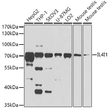 Anti-IL4I1 Polyclonal Antibody (CAB8378)