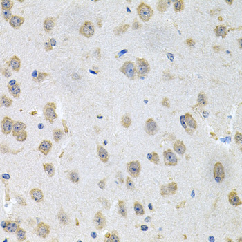 Anti-GNE Polyclonal Antibody (CAB8570)