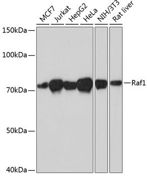 Anti-Raf1 Antibody (CAB19638)