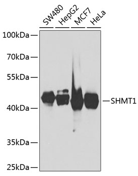 Anti-SHMT1 Antibody (CAB7727)