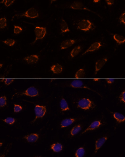 Anti-PDHA1 Antibody (CAB1895)