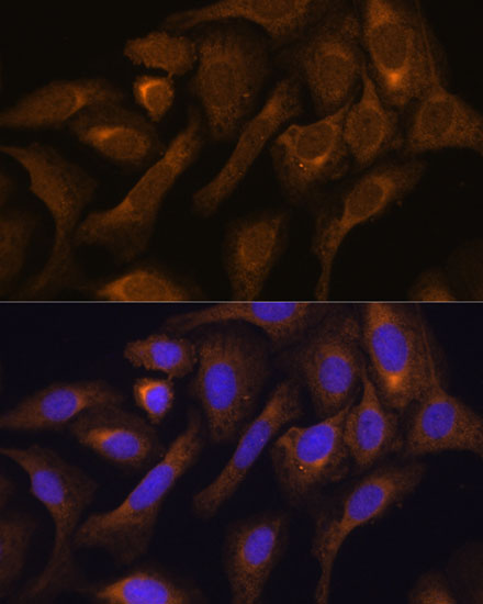 Anti-SHMT1 Antibody (CAB12489)