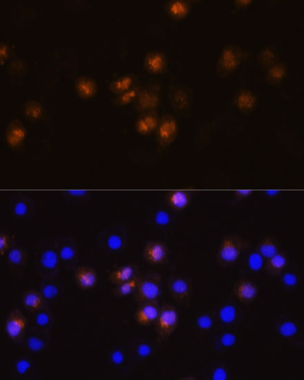 Anti-SWAP70 Antibody (CAB14857)