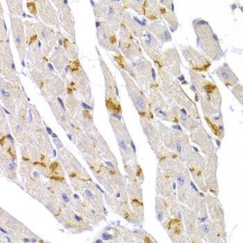 Anti-DSP Antibody (CAB13299)