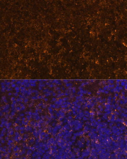 Anti-KLRC4 Antibody (CAB14807)