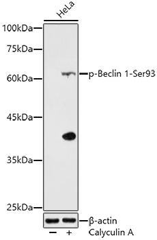 Western blot analysis of extracts of HeLa cells, using Phospho-Beclin 1-Ser93 antibody at 1:500 dilution. HeLa cells were treated by Calyculin A (100 nM) at 37Ã¢â€žÆ’ for 30 minutes. Secondary antibody: HRP Goat Anti-Rabbit IgG (H+L) at 1:10000 dilution. Lysates/proteins: 25ug per lane. Blocking buffer: 3% nonfat dry milk in TBST. Detection: ECL Enhanced Kit. Exposure time: 180s.