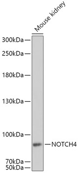 Anti-NOTCH4 Polyclonal Antibody (CAB8303)