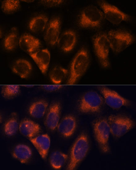 Anti-NDRG4 Antibody (CAB16195)