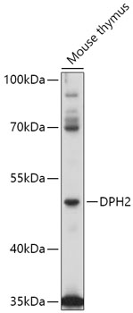 Anti-DPH2 Antibody (CAB17475)