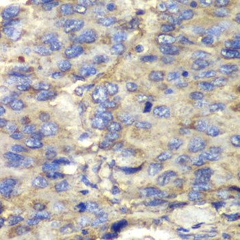 Anti-SDHA Antibody (CAB2594)