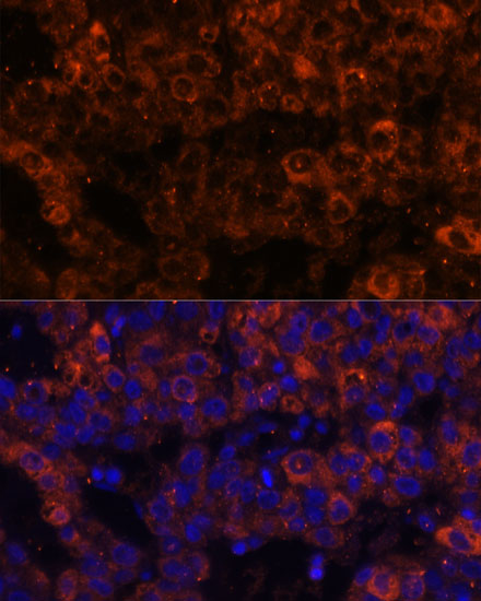 Anti-SERPINE1 Antibody (CAB6211)