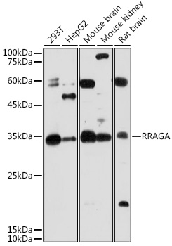 Anti-RRAGA Antibody (CAB7771)