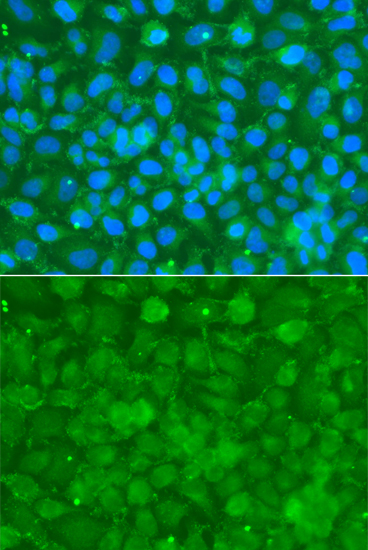 Anti-SERPINA3 Antibody (CAB1021)