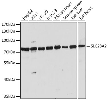 Anti-SLC28A2 Antibody (CAB16086)