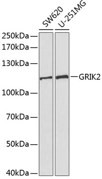 Anti-GRIK2 Antibody (CAB1939)