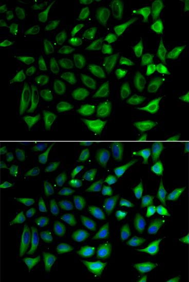 Anti-SLC25A20 Antibody (CAB6880)