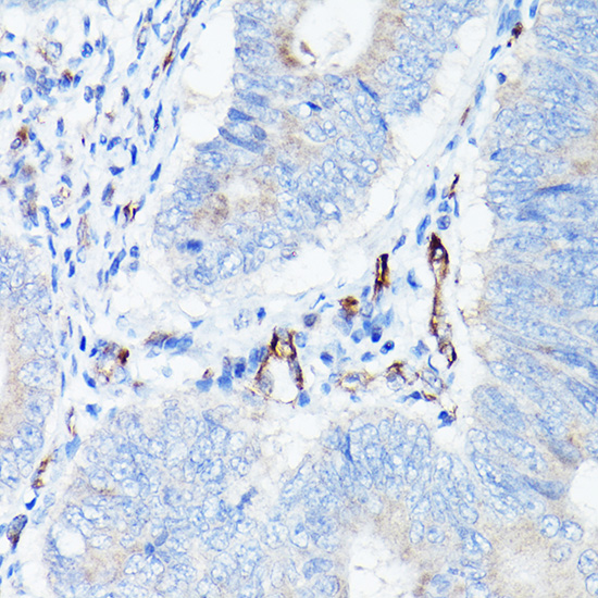 Anti-CDH5 Antibody (CAB12416)