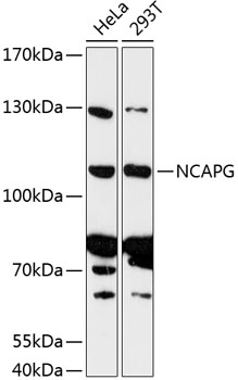 Anti-NCAPG Antibody (CAB13123)