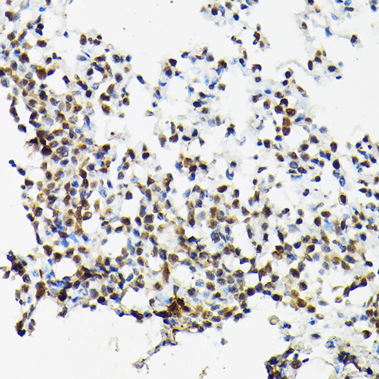 Anti-SRSF2 Antibody (CAB3635)