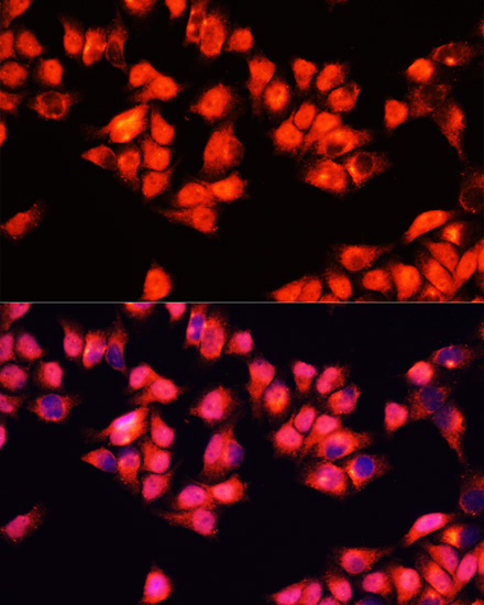 Anti-ADRA1A Antibody (CAB7873)