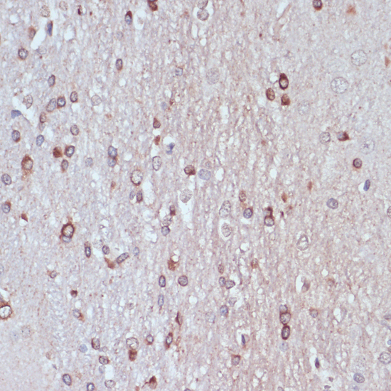 Anti-TPD52 Antibody (CAB10254)