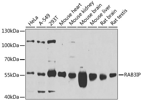 Anti-RAB3IP Polyclonal Antibody (CAB8094)