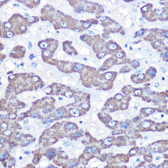 Anti-GOT2 Antibody (CAB6915)