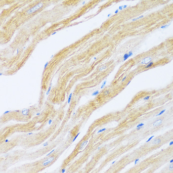 Anti-ATP2A2 / SERCA2 Antibody (CAB0098)