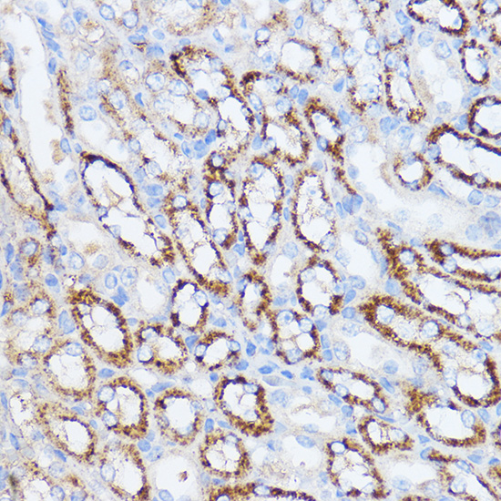 Anti-IL-11 Antibody (CAB1902)