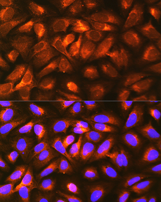 Anti-LRPAP1 Antibody (CAB13026)