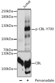 Anti-Phospho-CBL-Y700 pAb (CABP0780)