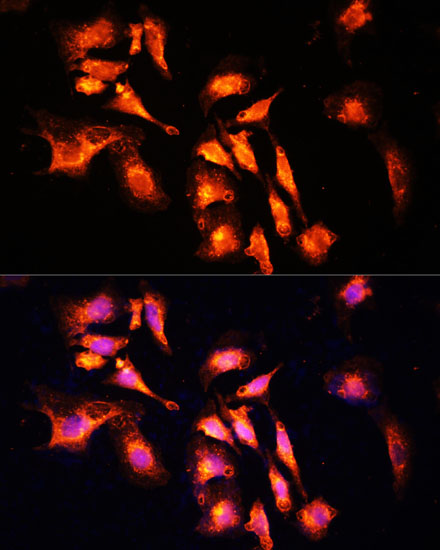 Anti-LAMTOR1 Antibody (CAB11619)