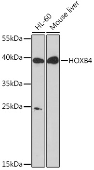Anti-HOXB4 Antibody (CAB16878)