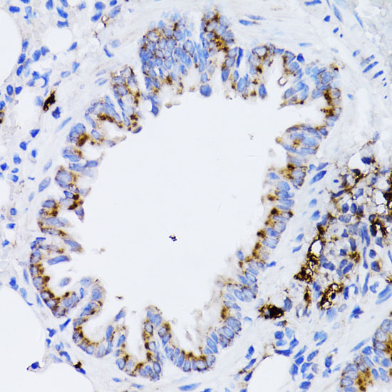 Anti-RARA Antibody (CAB0370)