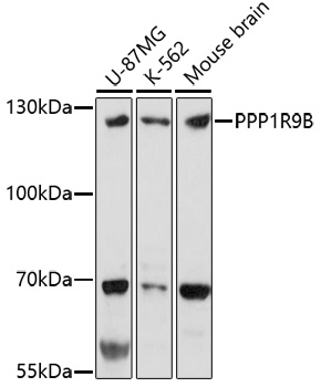 Anti-PPP1R9B Antibody (CAB17230)