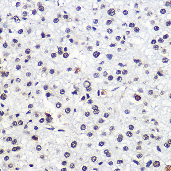 Anti-MSH6 Antibody (CAB0983)