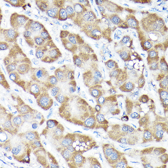 Anti-NRF2 Antibody (CAB11159)