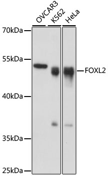 Anti-FOXL2 Antibody (CAB16244)