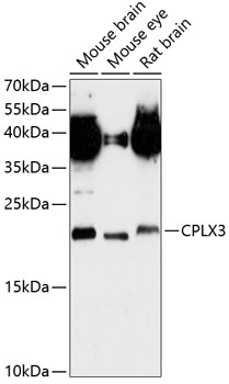 Anti-CPLX3 Antibody (CAB13694)