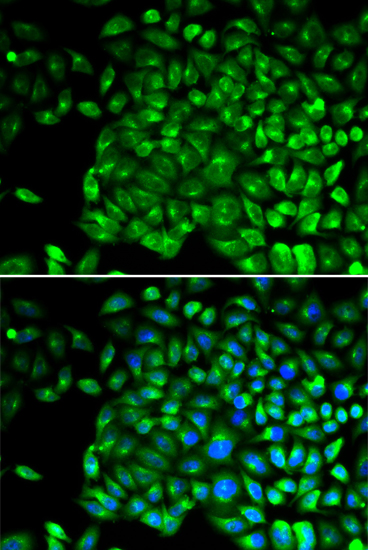 Anti-TNFRSF1B Antibody (CAB0387)