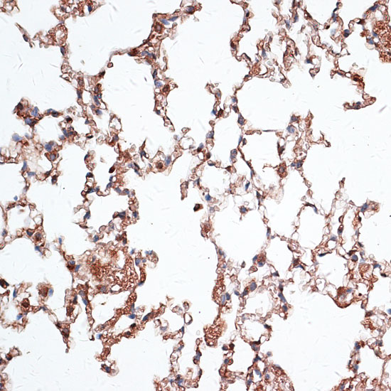 Anti-Vimentin Antibody (CAB2584)