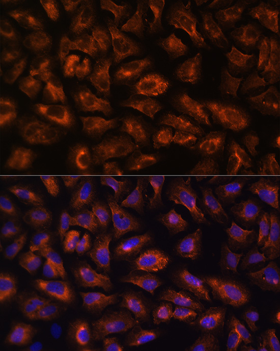 Anti-FLT4 Antibody (CAB5605)