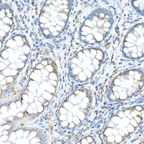 Immunohistochemistry of paraffin-embedded human colon using FAM3A Rabbit pAb at dilution of 1:50 (40x lens). Perform high pressure antigen retrieval with 10 mM citrate buffer pH 6. 0 before commencing with IHC staining protocol.