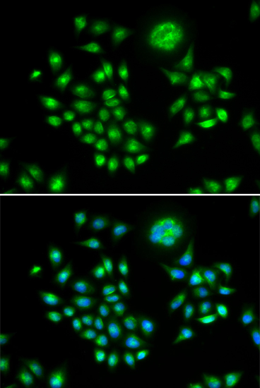 Anti-AGFG1 Antibody (CAB13500)