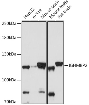 Anti-IGHMBP2 Antibody (CAB16053)