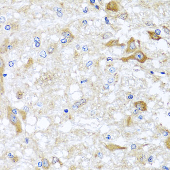 Anti-ABCB8 Antibody (CAB2653)