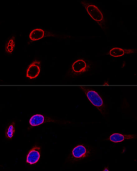 Anti-EMD Antibody (CAB1132)